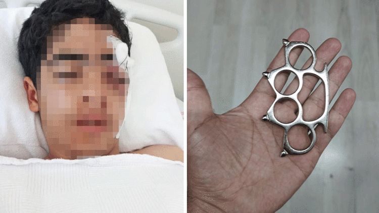 Esenyurt'ta Akran Zorbalığı Dehşeti: 15 Yaşındaki Çocuk Hastanelik Oldu!